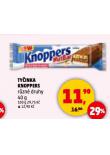TYINKA KNOPPERS